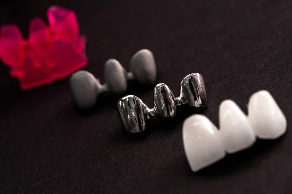 Stainless Steel vs. White Crowns for Kids: Which Is Right for Your Child?